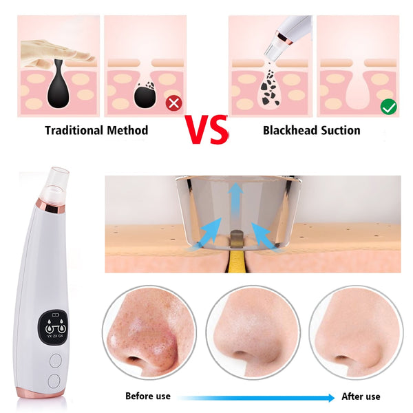 Facial Cleaner Neus Comedondrukker Deep Pore Acne Puistje Removal Vacuüm Zuig Diamond T Zone Beauty Tool Gezicht Huishoudelijke Spa