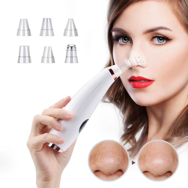 Facial Cleaner Neus Comedondrukker Deep Pore Acne Puistje Removal Vacuüm Zuig Diamond T Zone Beauty Tool Gezicht Huishoudelijke Spa